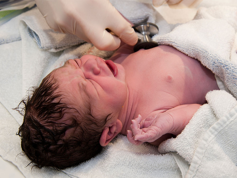 Why You Need a Los Angeles Birth Injury Attorney for Your Child’s Future